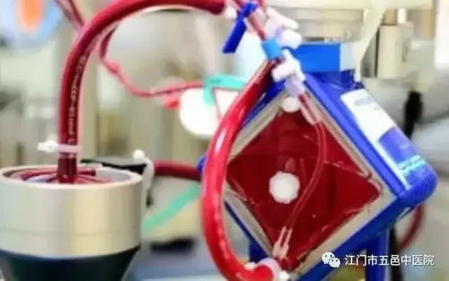 江門市首例跨院體外膜肺轉(zhuǎn)運(yùn)成功,創(chuàng)造醫(yī)學(xué)奇跡